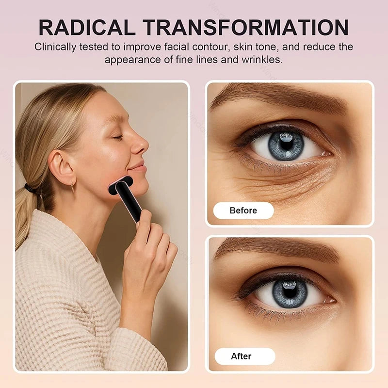 Lift Your Jawline in 10 Minutes a Day